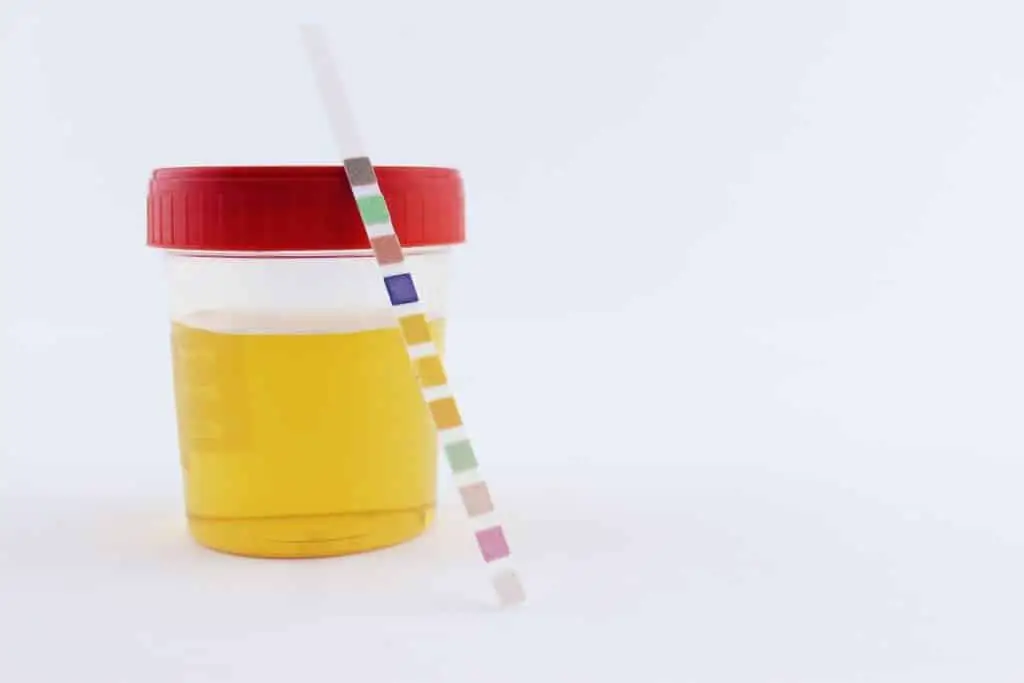 Des urines foncées et en quantité réduite peuvent témoignées d'un début de déshydratation